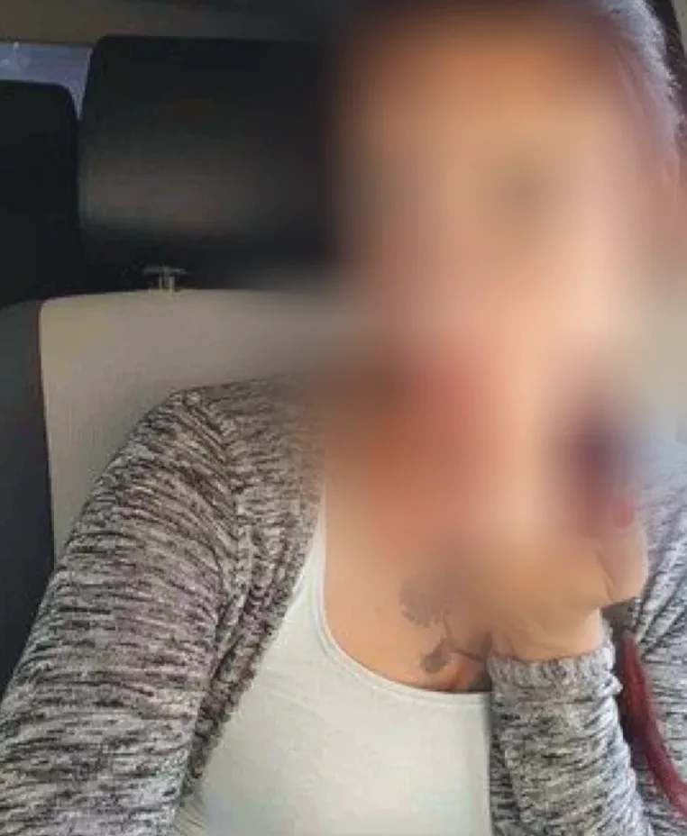 Lilja, 39